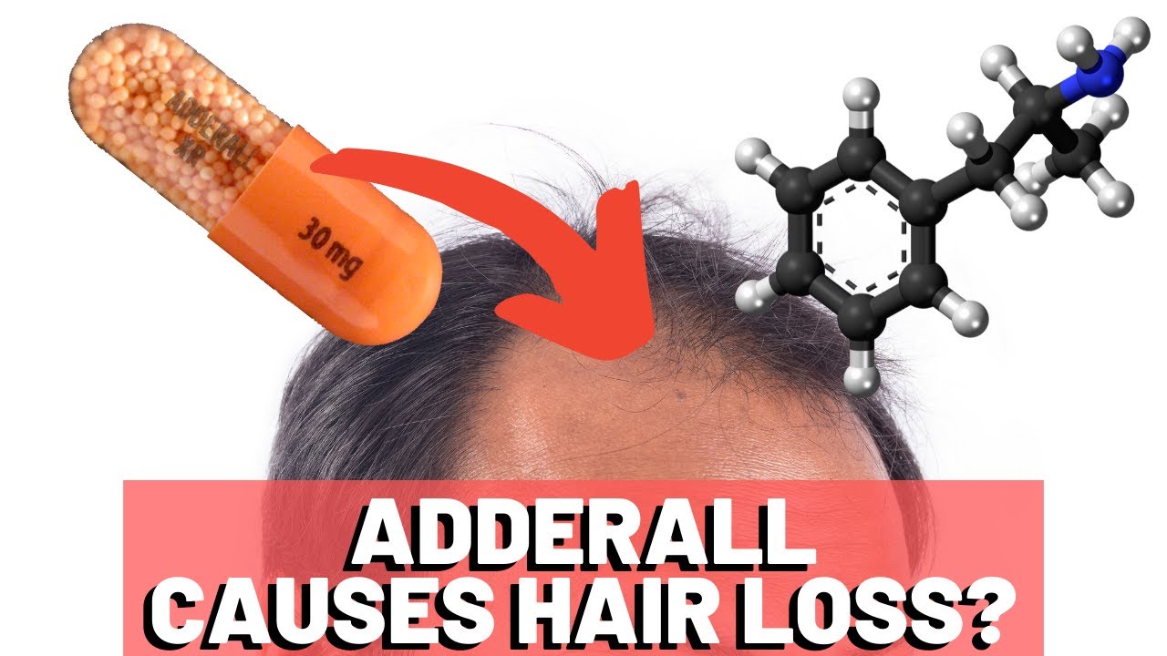 Preview Yeray Tests Positive for Doping: “Caused by Hair Loss Medication”